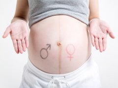 胎儿性别鉴定为什么不是在医院做？