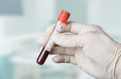 香港验血测男女条件是什么