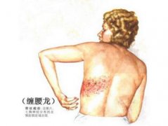 香港生蛇疫苗到底有什么作用？哪些人有必要接