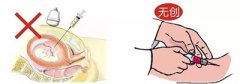 什么是香港无创DNA产前检测，最近热门话题!