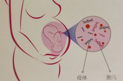 无创产前基因检测要注意什么？