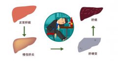 达叔肝癌的背后，别等到自己倒下才知道爱惜身
