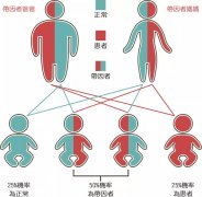 地中海贫血不可轻视!
