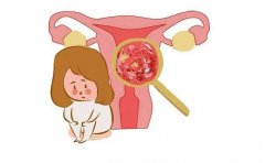 这种病特别“重女轻男”，女性朋友千万别忽视...